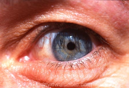 cornea;eye;eyeball;eyelash;eyelashes;iris;socket